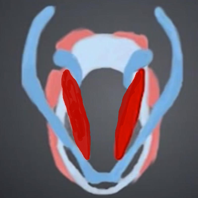 Thyroarytenoid muscle